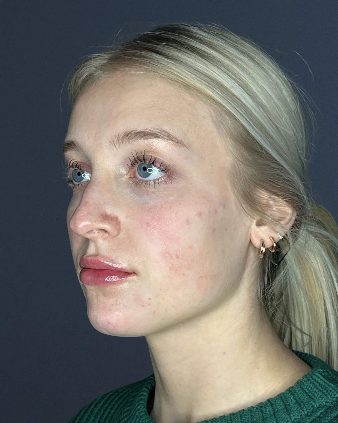 A close-up photo of a young blond woman's face