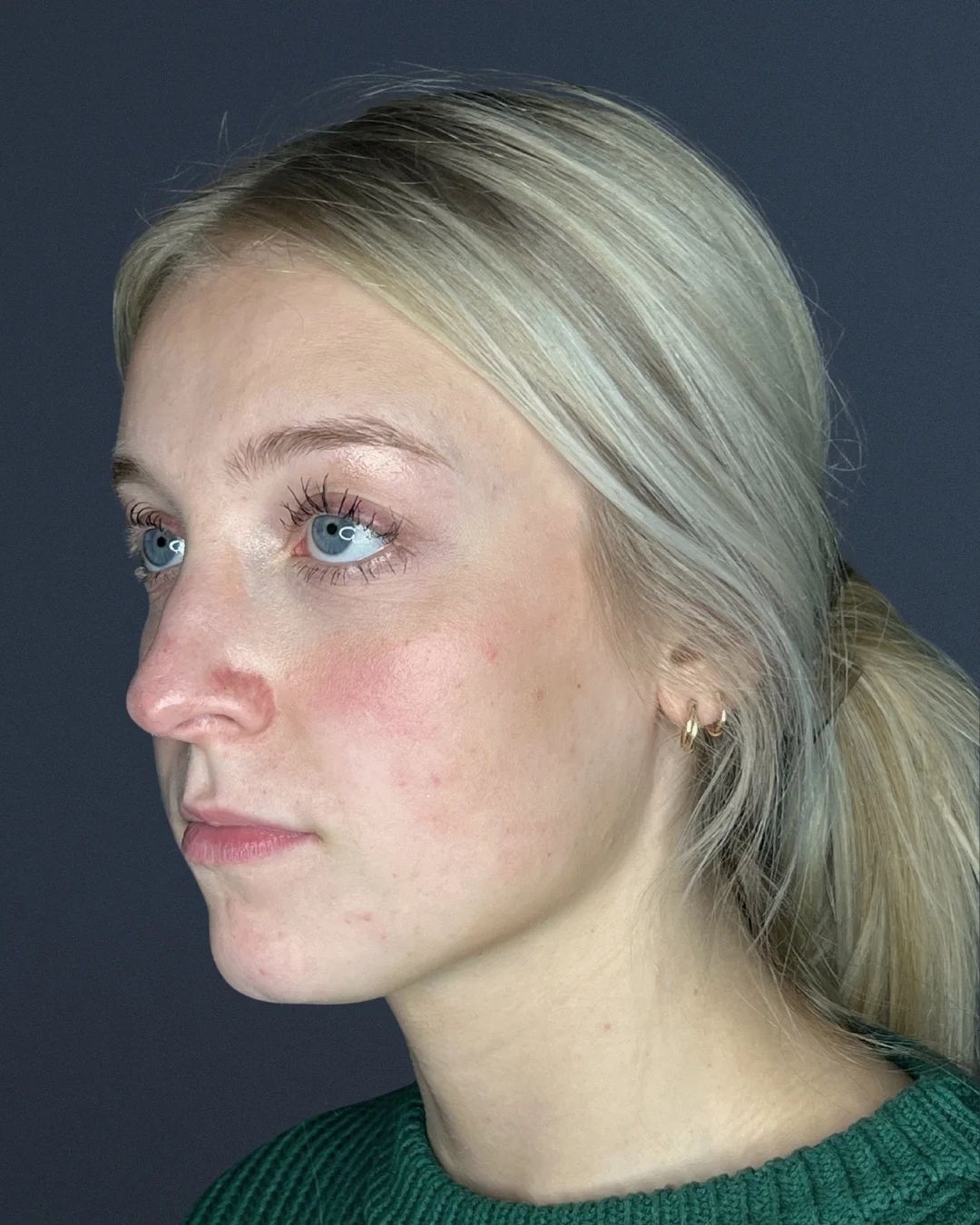 Profile view of a blonde woman with blue eyes and light skin wearing a green sweater against a dark gray background.