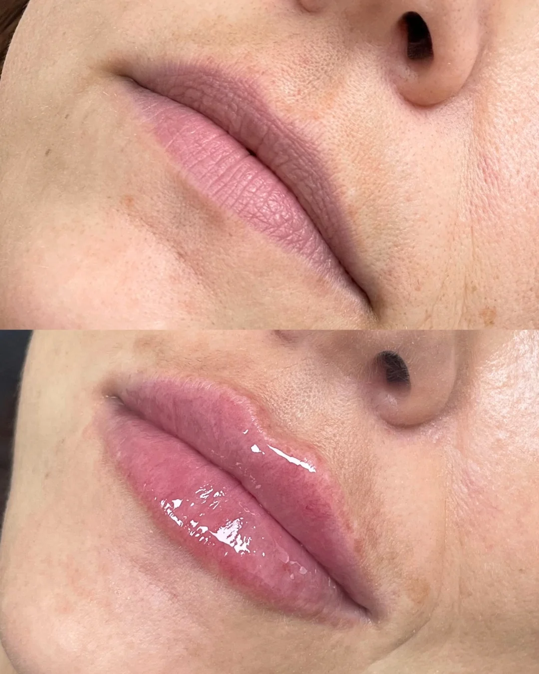 Before/after photo of a woman's lips.