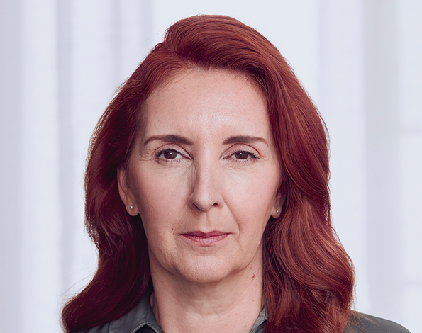 Before shot of a woman with red hair who has received a Botox injection.