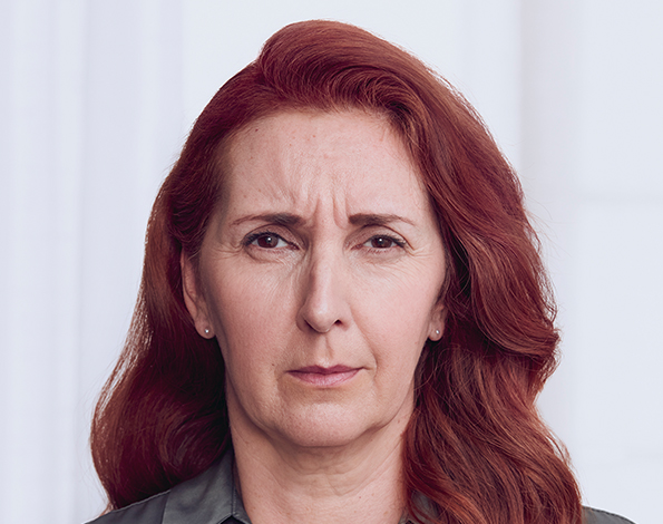 Before shot of a woman with red hair who has not yet received a Botox injection.